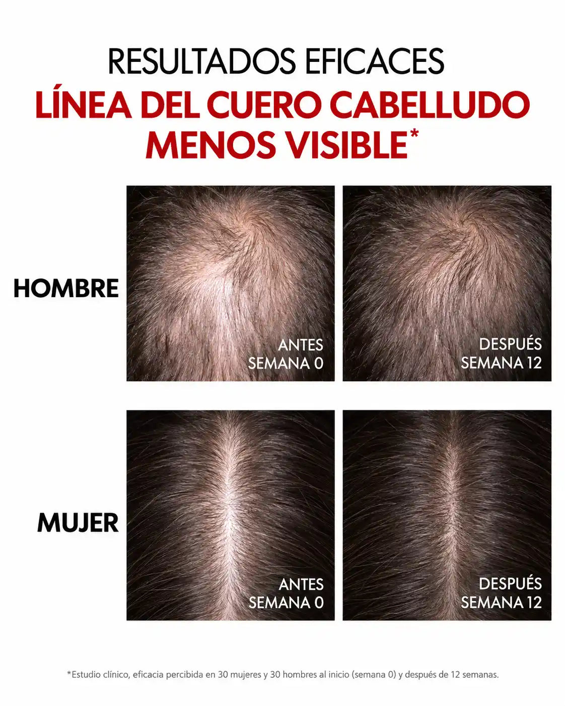 VICHY Dercos Serum Aminexil Regen Booster - anticaída del cabello
