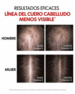 VICHY Dercos Serum Aminexil Regen Booster - anticaída del cabello - imagen 4
